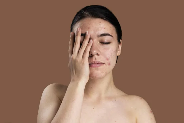 Skin Related Issues